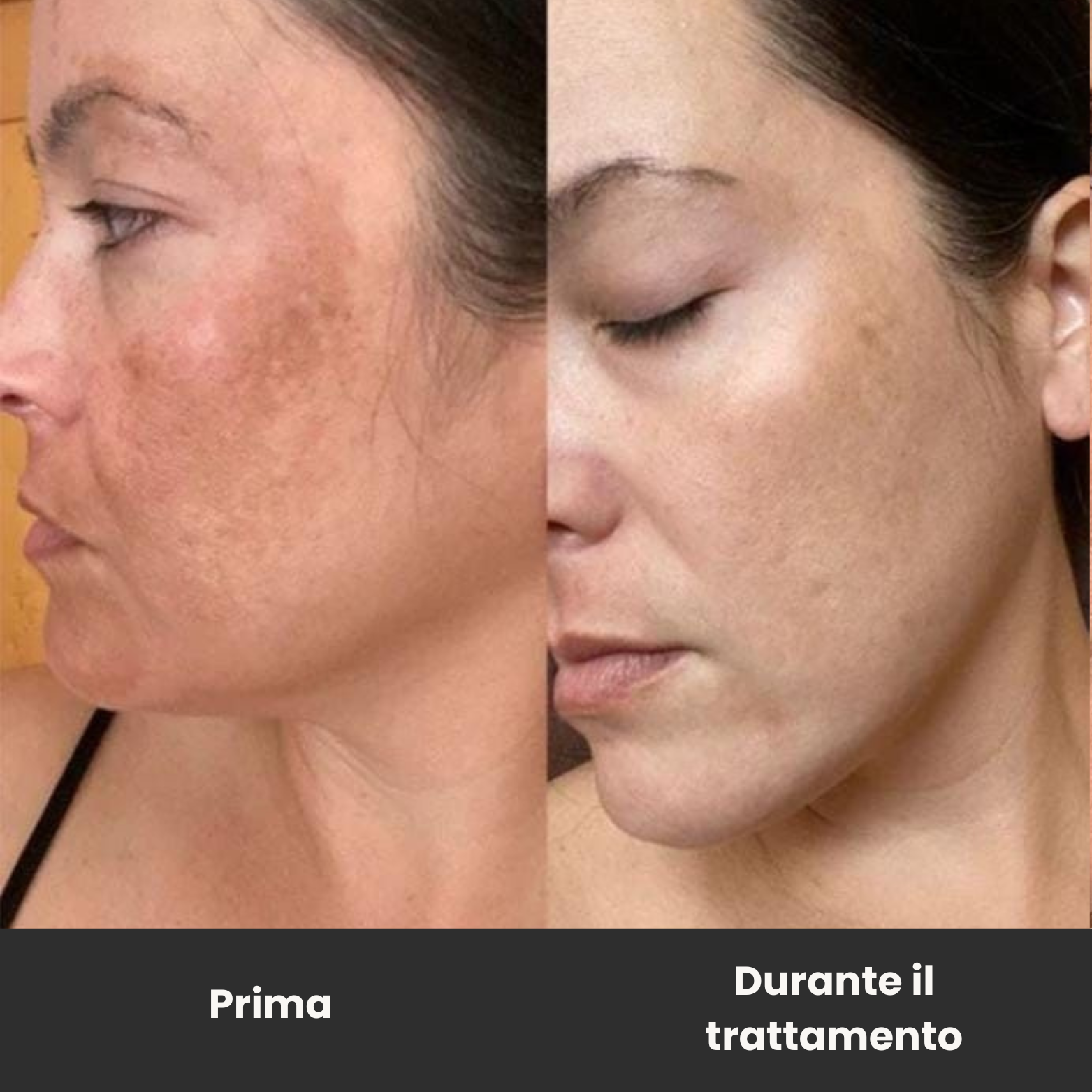 Trattamento Rigenerante Multi-Attivo a base di Bava di Lumaca