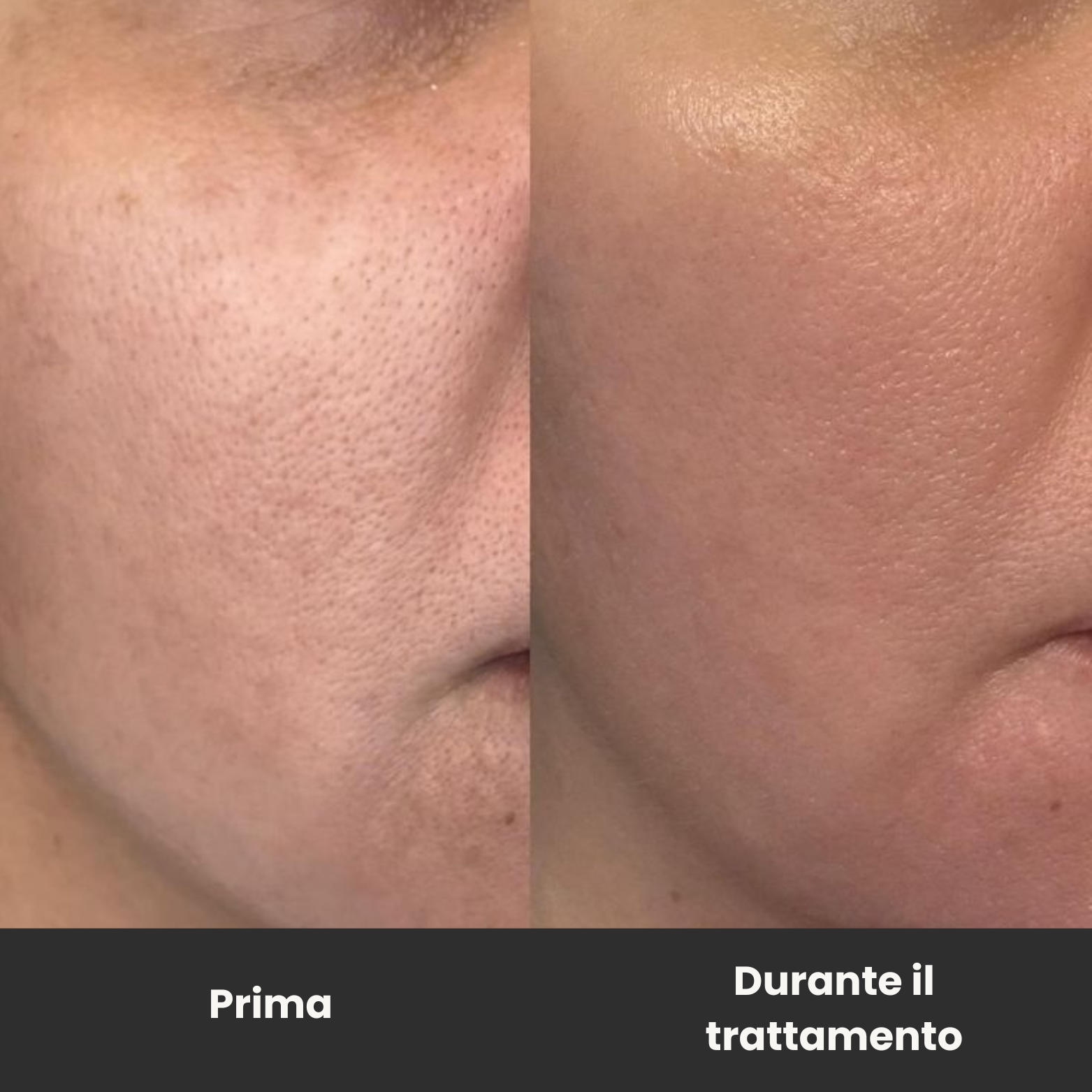 Trattamento Rigenerante Multi-Attivo a base di Bava di Lumaca