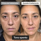 Trattamento Viso Doposole alla Bava di Lumaca