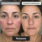 Trattamento Viso Doposole alla Bava di Lumaca