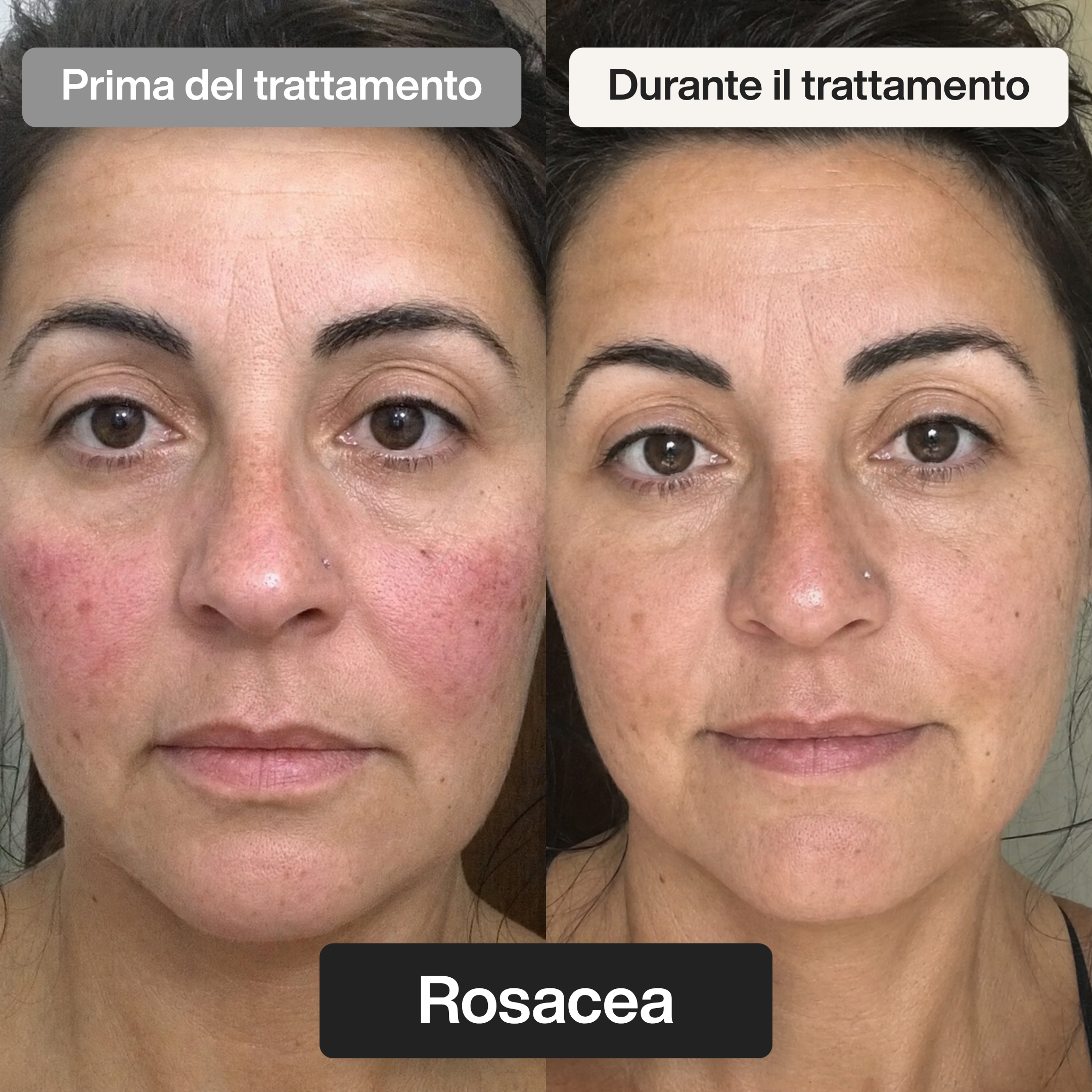 Trattamento Viso Doposole alla Bava di Lumaca