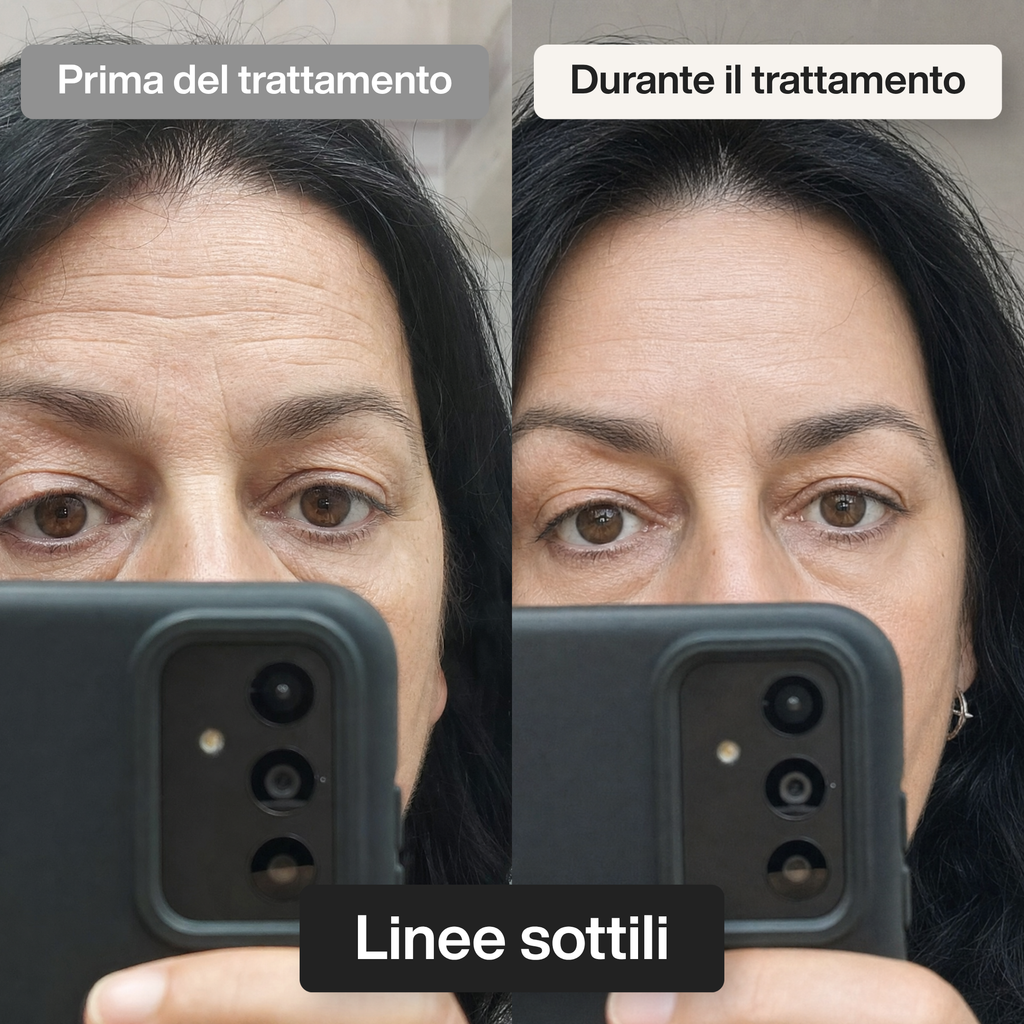 Trattamento Viso Doposole alla Bava di Lumaca