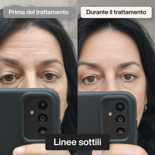 Trattamento Rigenerante Multi-Attivo a base di Bava di Lumaca
