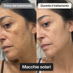 Trattamento Viso Doposole alla Bava di Lumaca
