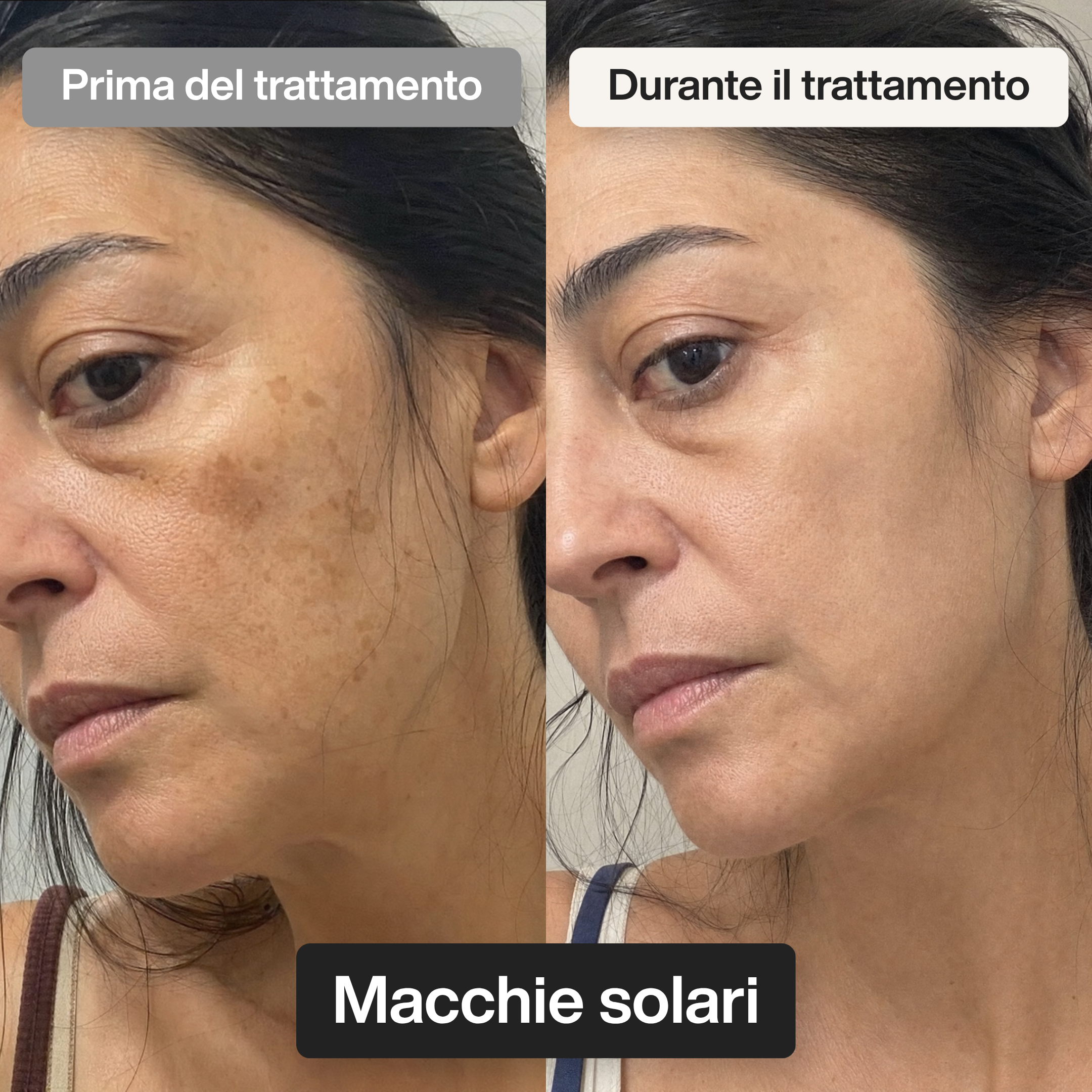 Trattamento Viso Doposole alla Bava di Lumaca
